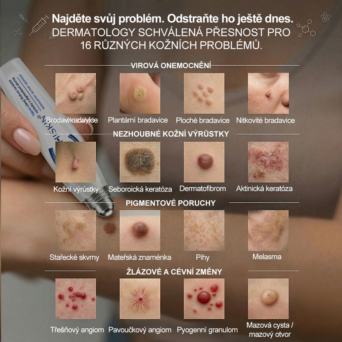 Oficiální značkový obchod | Hiskin® 7denní odstraňovač skvrn a pigmentových skvrn (Bezbolestný rollerball bez jizev)🐬